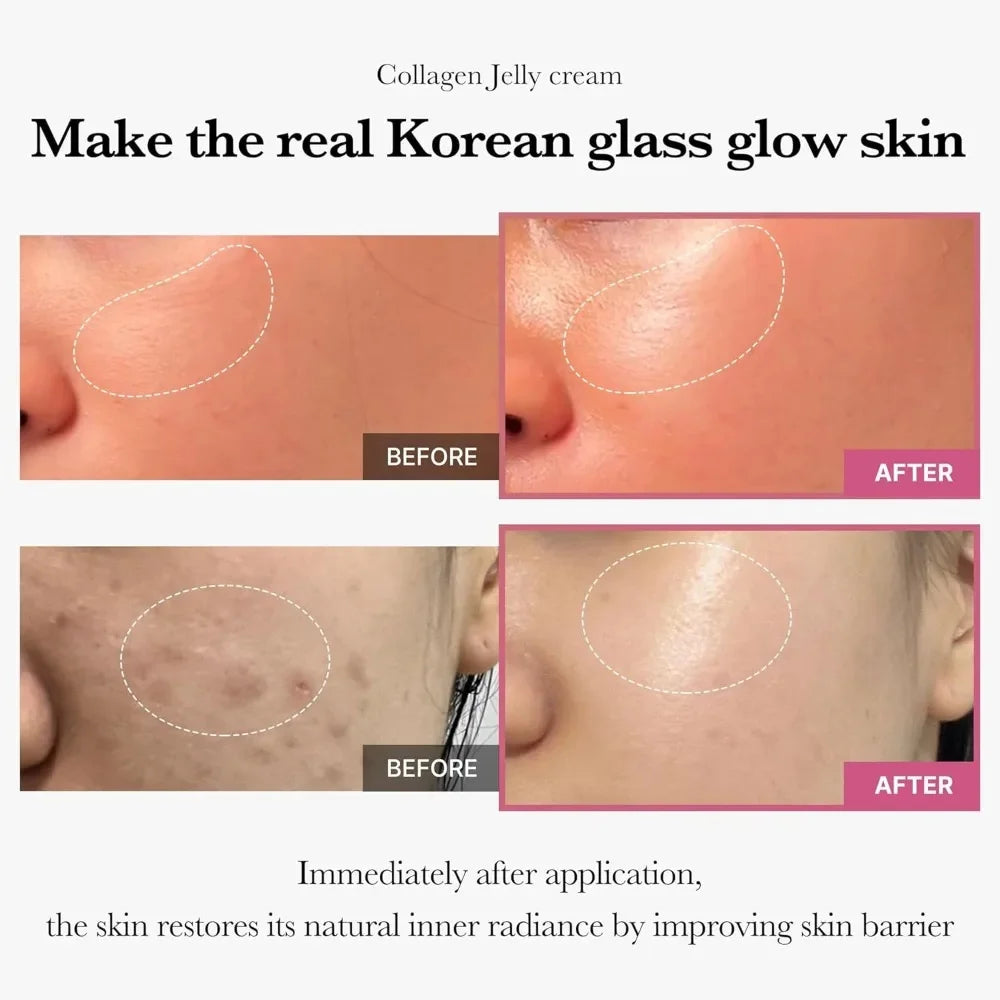 Collagen Jelly Hydrating Cream